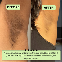 The Korean Toner Pads – Fade Dark Spots & Wrinkles Fast