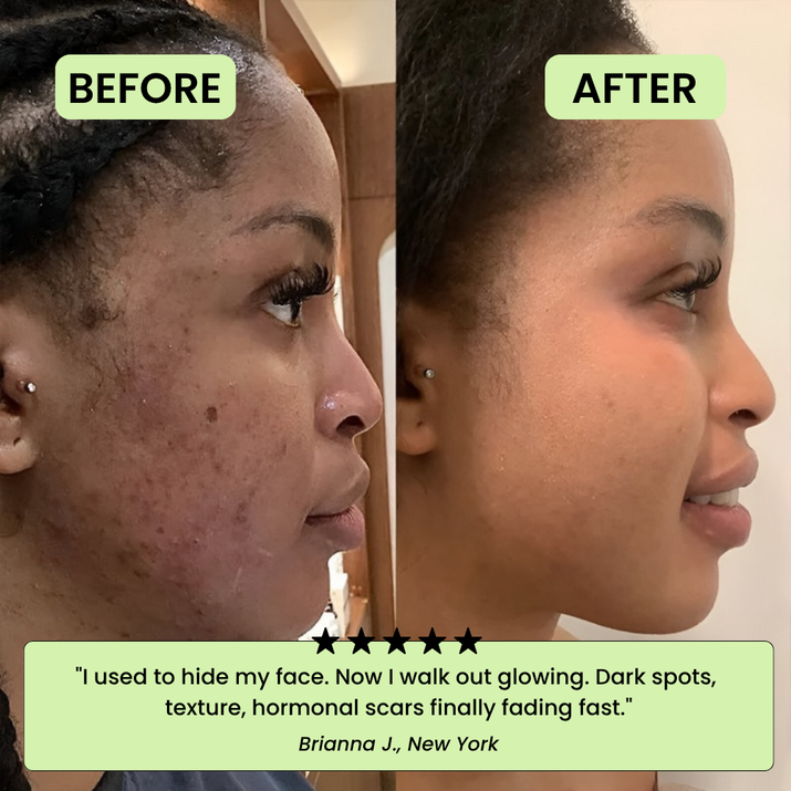 The Korean Toner Pads – Fade Dark Spots & Wrinkles Fast