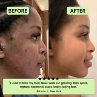 The Korean Toner Pads – Fade Dark Spots & Wrinkles Fast