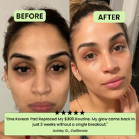 The Korean Toner Pads – Fade Dark Spots & Wrinkles Fast