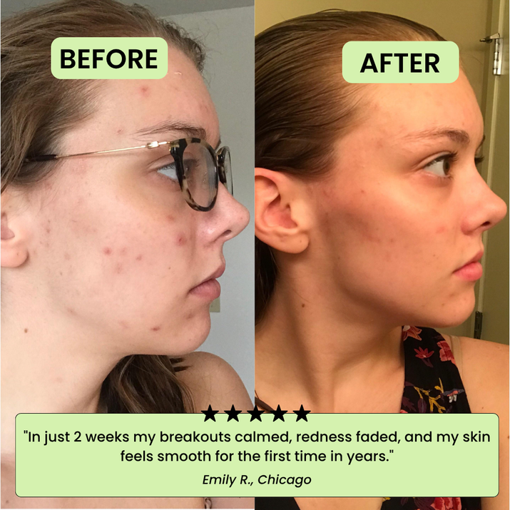 The Korean Toner Pads – Fade Dark Spots & Wrinkles Fast