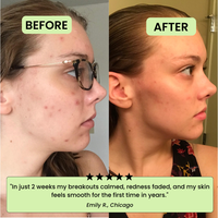 The Korean Toner Pads – Fade Dark Spots & Wrinkles Fast