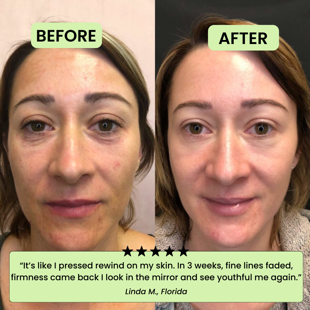 The Korean Toner Pads – Fade Dark Spots & Wrinkles Fast