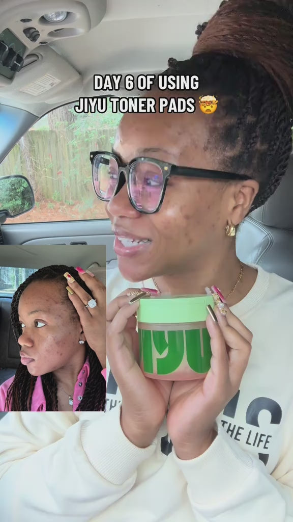 The Korean Toner Pads – Fade Dark Spots & Wrinkles Fast video