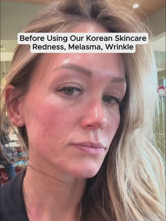 The Korean Toner Pads – Fade Dark Spots & Wrinkles Fast video